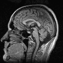 [Image: Thom's brain]